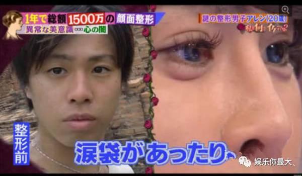 日本整容男网红,逆天颜值背后的故事